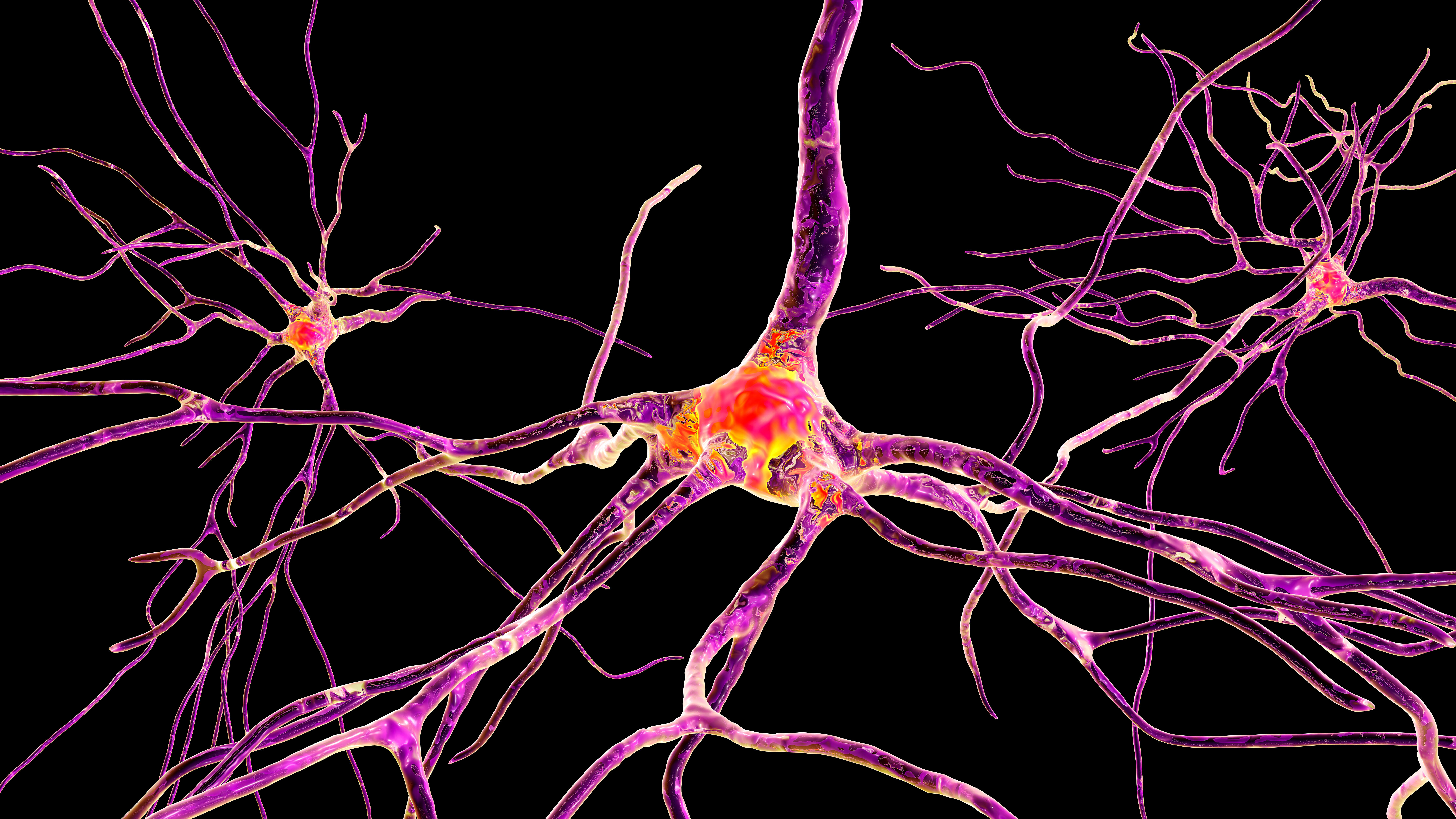 3-D rendering of a neuron with glowing synapses, showing dendrites, axon, and neural connections on a dark background
